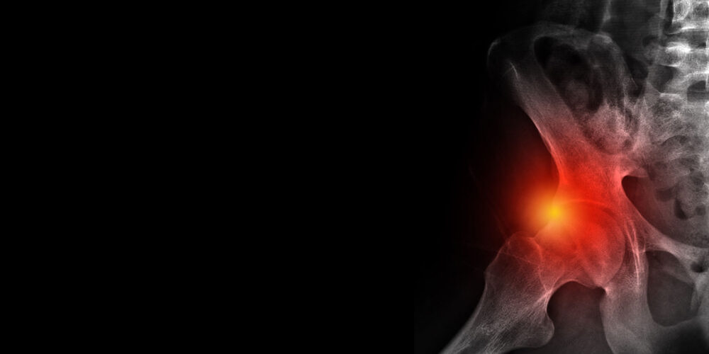 shutterstock_1446818366 shutterstock_1446818366