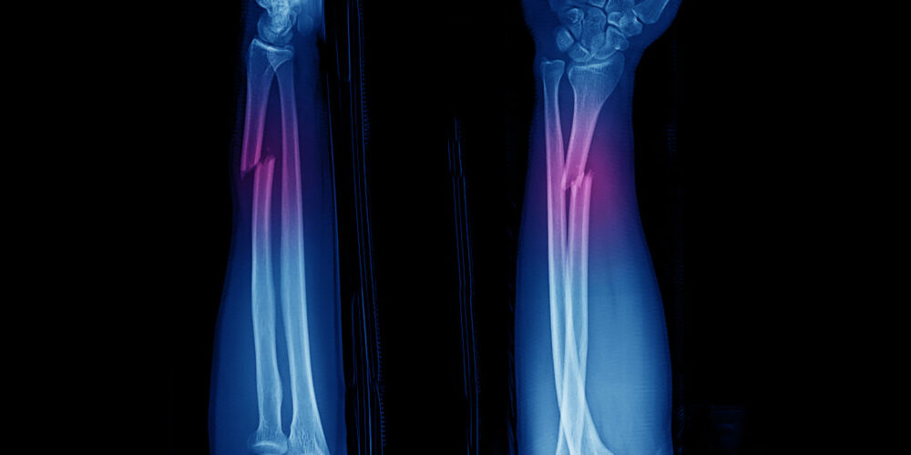 shutterstock_1565499775 shutterstock_1565499775