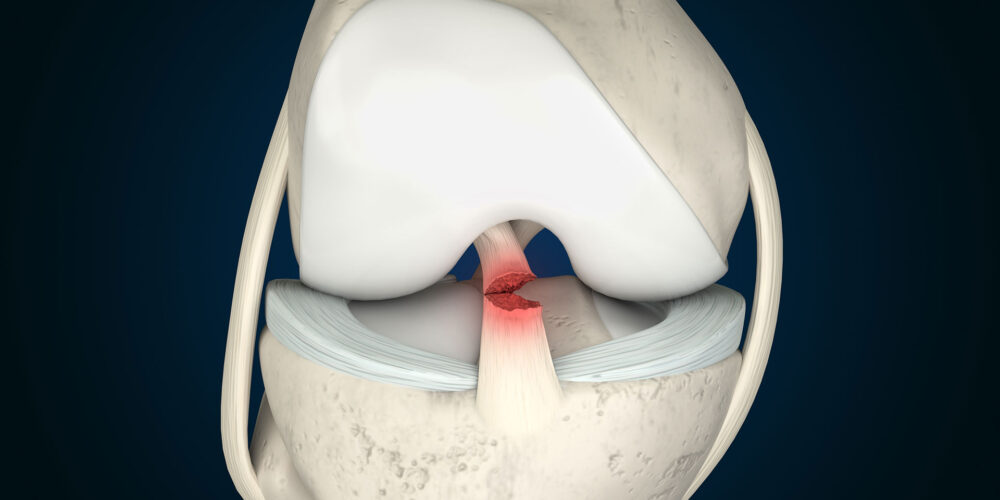 shutterstock_2082470089 shutterstock_2082470089