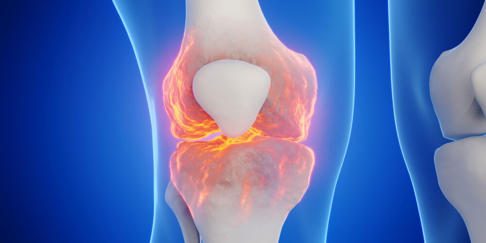 shutterstock_2232669557