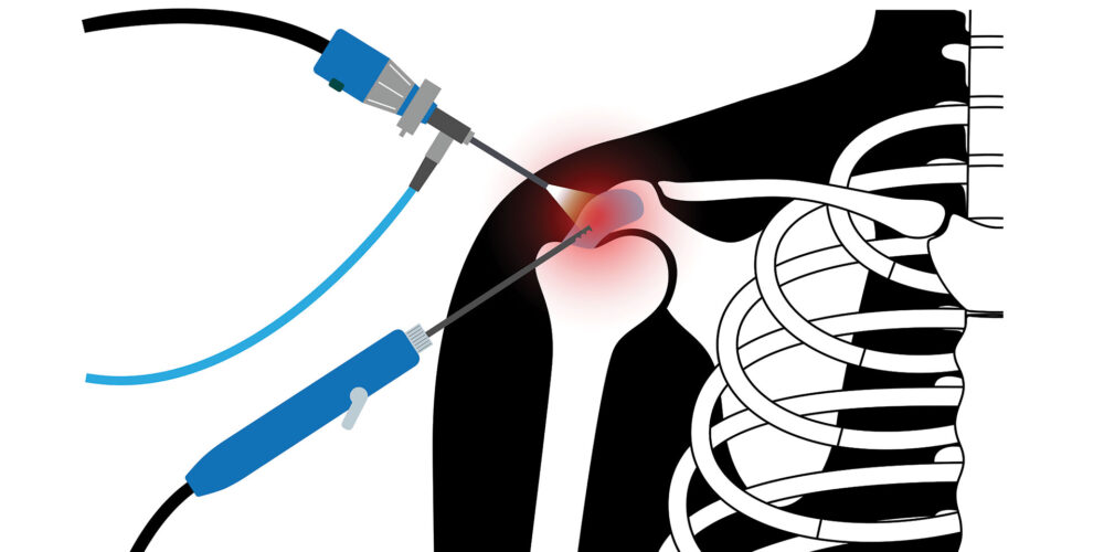 shutterstock_2342544085